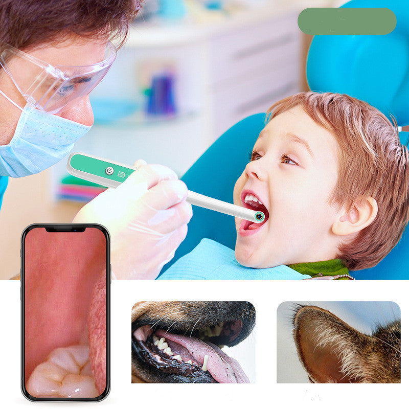 Wireless HD Dental Endoscope
